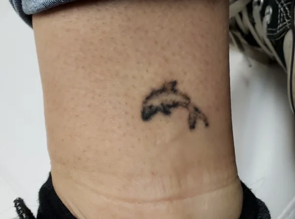 Before: small dolphin tattoo above the ankle