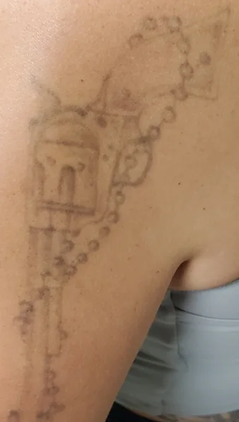 Before: revolver and rosary tattoo on the upper arm